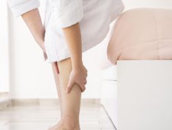Varises Bukan Sekadar Masalah Penampilan, Dokter Ingatkan Risiko Gangguan Sirkulasi