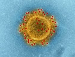 Pemkab Tangerang Siagakan Fasilitas Kesehatan Antisipasi Hantavirus